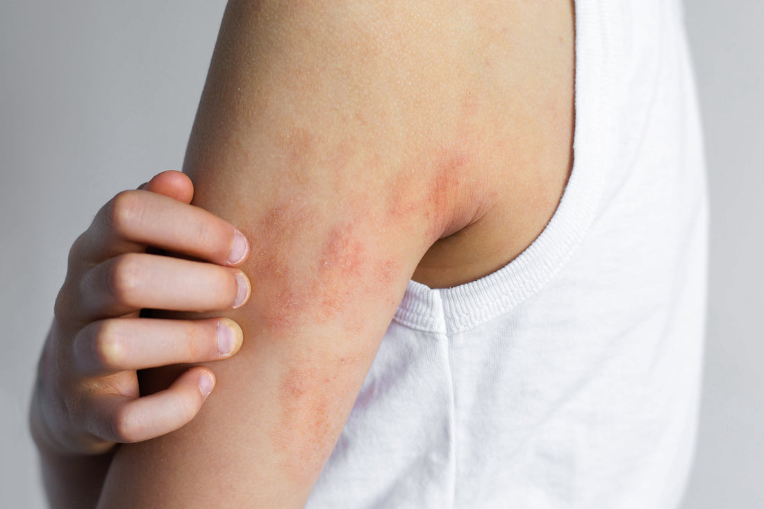 Person scratching itchy skin