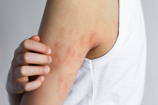Person scratching itchy skin